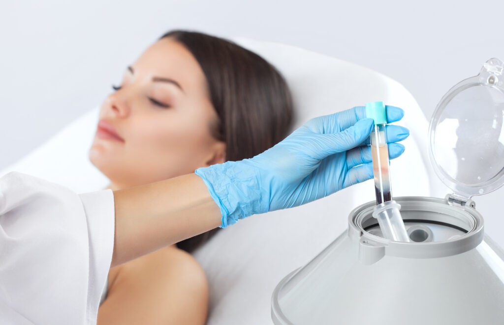 blood sample tube being removed from a centrifuge for PRP plasma lifting procedure