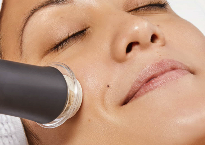close up of an Oxypod device applied to a woman's cheek during a facial treatment