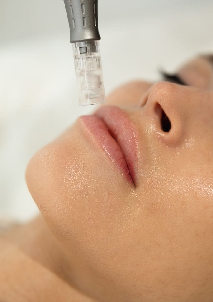 Close-up of SL Nano Infusion Facial device applying serum to lips and lower face for enhanced skin hydration and glow