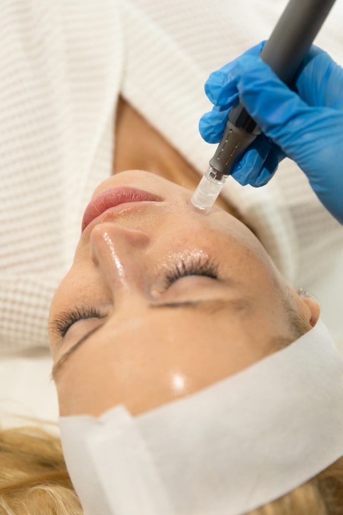 SL Nano Infusion Facial in progress showing serum application with nano-needling device